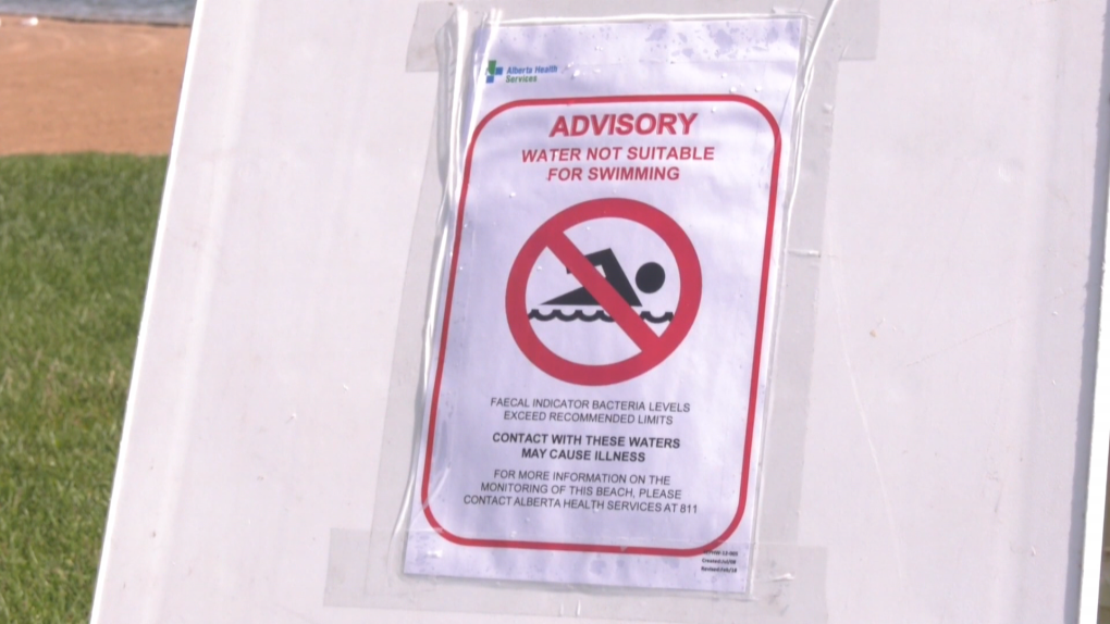 A sign at a Chestermere Lake beach advising against going into the water due to the elevated fecal bacteria levels on June 17.