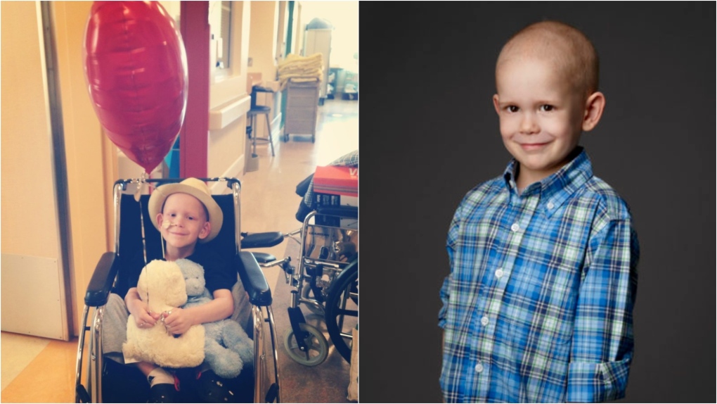 Luca was diagnosed with anaplastic medulloblastoma, an aggressive brain cancer, at the age of four. 