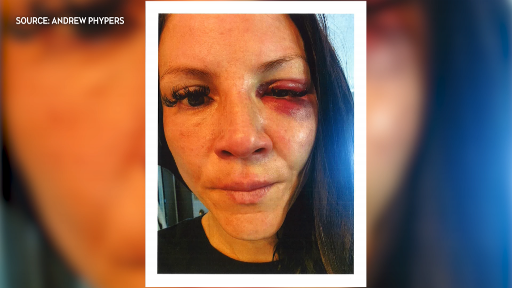 Laura Phypers's lawyer says she was assaulted during an altercation with an Innisfail RCMP officer on June 3, 2023. (Supplied/Andrew Phypers)
